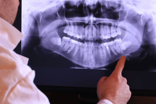 Best Weekend Emergency Dentist in Fox Island, WA