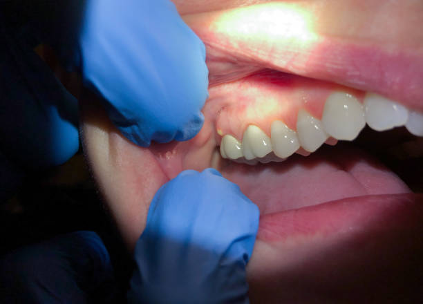 Best Emergency Cosmetic Dentistry in Fox Island, WA