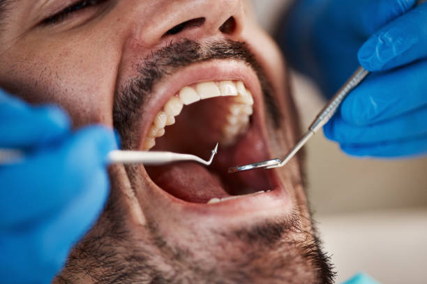 Best Mobile Emergency Dentist in Fox Island, WA